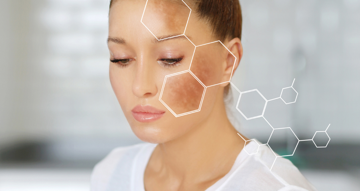 How To Get Rid Of Dark Spots & Uneven Skin Tone