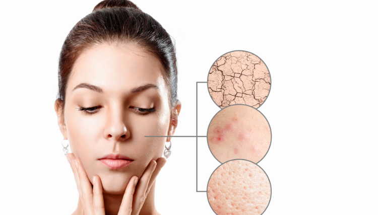 Dry Skin: Causes, Symptoms and Solutions