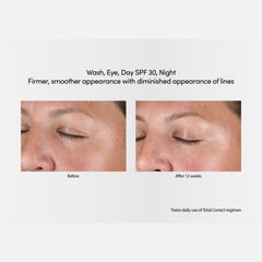 Exuviance Professional Total Correct Day SPF 30 50g / Age Reverse Day Repair SPF 30 Face Cream with Retinol 50g