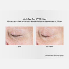 Exuviance Professional Total Correct Day SPF 30 50g / Age Reverse Day Repair SPF 30 Face Cream with Retinol 50g