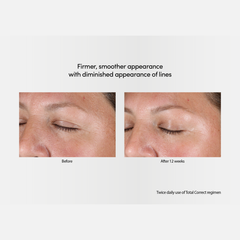 Exuviance Professional Total Correct Night 50g / AGE REVERSE Night Lift Antiaging Face Cream 50g