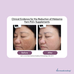 Heliocare Fern PLE+ 240mg | 60caps