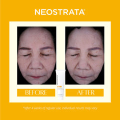 Neostrata Enlighten Dark Spot Corrector | 20g