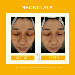 Neostrata Enlighten Dark Spot Corrector | 20g