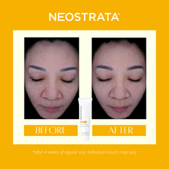 Neostrata Enlighten Dark Spot Corrector | 20g