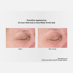 Exuviance Professional Total Correct Eye 15g / Exuviance-R Age Reverse+ Total 360 Eye Contour 15g