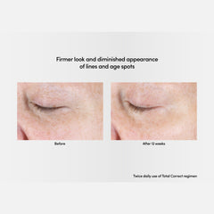 Exuviance Professional Total Correct Eye 15g / Exuviance-R Age Reverse+ Total 360 Eye Contour 15g