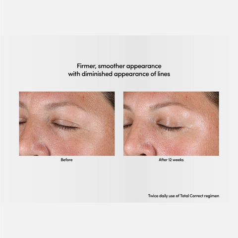 Exuviance Professional Total Correct Eye 15g / Exuviance-R Age Reverse+ Total 360 Eye Contour 15g