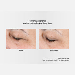 Exuviance Professional Total Correct Serum 30ml / Exuviance-R Age Reverse + Advanced Total Correct Serum 30ml