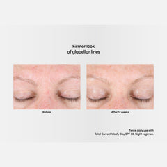 Exuviance Professional Total Correct Serum 30ml / Exuviance-R Age Reverse + Advanced Total Correct Serum 30ml