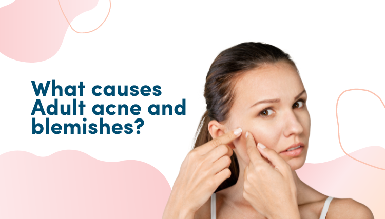 What Causes Adult Acne And Blemishes?