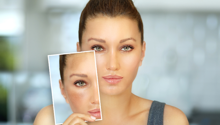 How to Get Rid of Dark Spots & Uneven Skin Tone