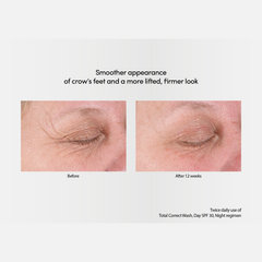 Exuviance-R Age Reverse+ Total 360 Eye Contour 15g