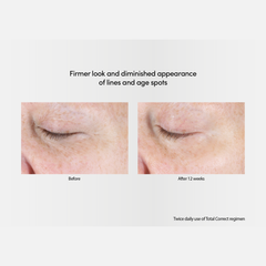 Exuviance-R Age Reverse+ Total 360 Eye Contour 15g