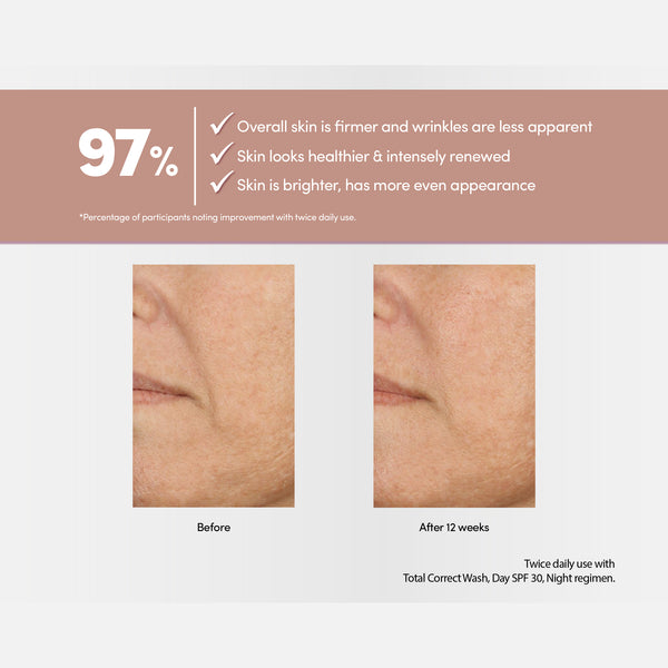 Exuviance Professional Total Correct Serum 30ml / Exuviance-R Age Reverse + Advanced Total Correct Serum 30ml