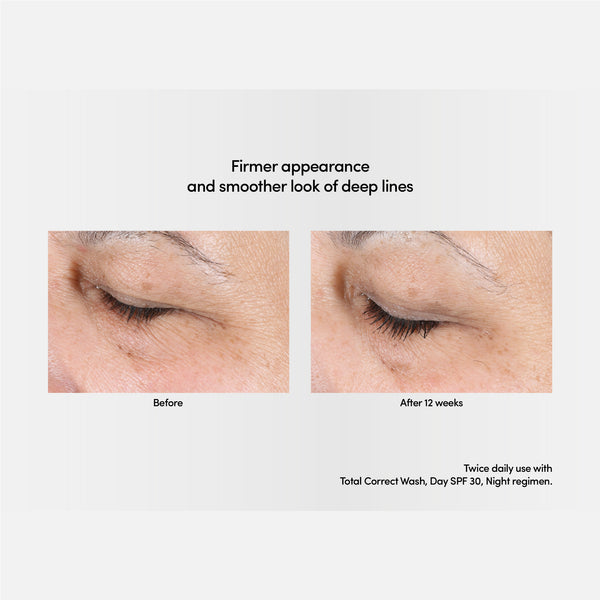 Exuviance Professional Total Correct Serum 30ml / Exuviance-R Age Reverse + Advanced Total Correct Serum 30ml