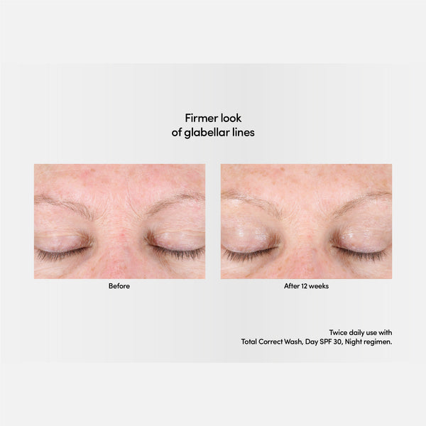 Exuviance Professional Total Correct Serum 30ml / Exuviance-R Age Reverse + Advanced Total Correct Serum 30ml